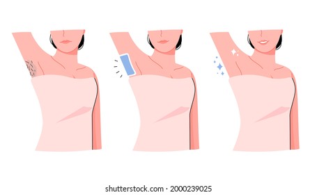 Waxing armpit hair. Hair removal, care concept person vector illustration.