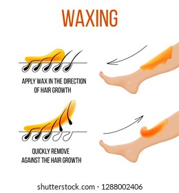 Waxing. Hair Removal. Smooth Clear Skin. Epilation And Depilation Of Hair.