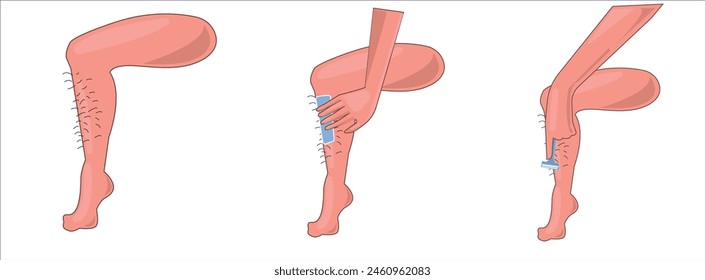 Waxing, human body wax, leg waxing hand drawing vector illustration