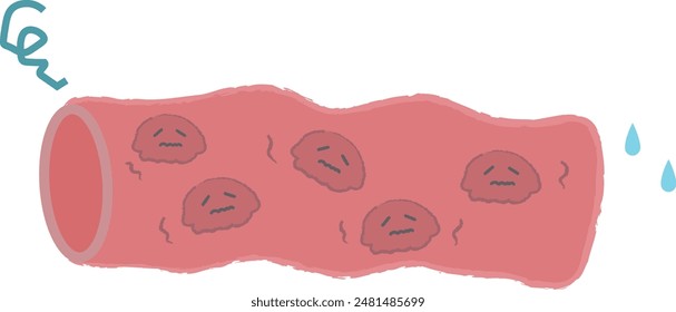 Weak blood vessels, muddy blood