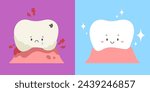 Weak tooth with lesions compare with strong tooth. Illustration of tooth decay, plaque, gum pain or gingivitis and healthy tooth. Concept of dental health, dentistry. Flat vector illustration cartoon.