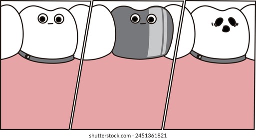 wearing different type of Dental crowns, dental treatment - flat illustration 