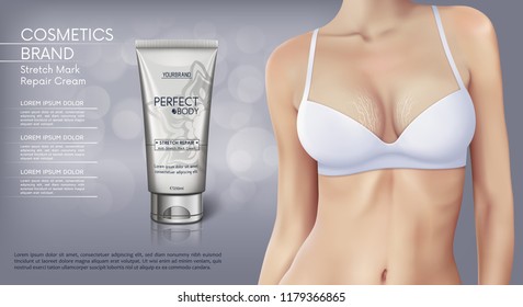 Web banner design of Stretch mark removal cream. Concept vector illustration of skin care and with woman with stretch marks on breast