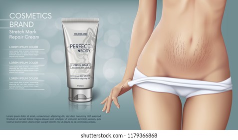 Web banner design of Stretch mark removal cream. Concept vector illustration of skin care and with woman with stretch marks on belly