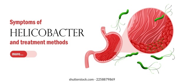 Web banner template with gastritis and helicobacter pylori. Healthcare vector illustration cartoon style
