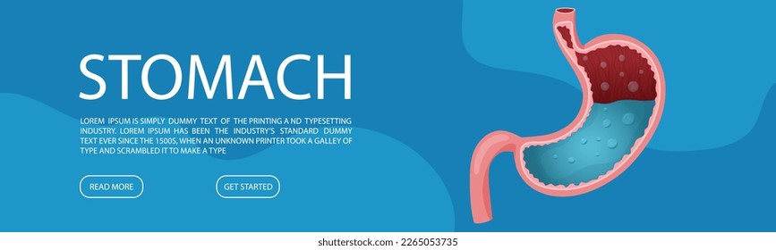Plantilla de banner web con estómago sano humano. Estilo de la caricatura de ilustraciones vectoriales
