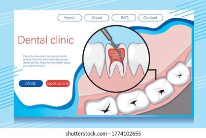 Web layout with teeth with caries or molars with pulpitis for the website of orthodontic, dental services. Molars and incisors top view. Vector stock illustration with layout or template for landing.