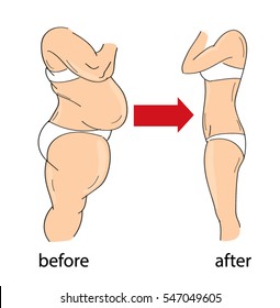 weight loss before and after