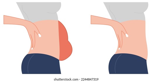 Weight loss, before and after, fat belly, close up body, female, problem area, abdomen. Fat and flat belly, slim belly