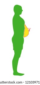 Weight loss concept. Fat and thin man. The influence of diet on the weight of the person. Young man profile before and after diet and fitness. Weight loss concept.