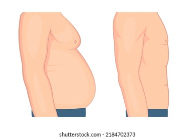 Abbildung des Gewichtsverlustes. Bauch eines Mannes vor und nach Gewichtsverlust. Vektorgrafik