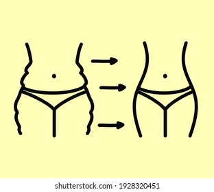 Weight Loss. Linear Silhouette Of A Woman. Vector Illustration.