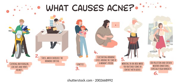 What causes acne. Harmful stressful  job, wrong clothing, genetics, air pollution. Skin problems. Common condition. Landscape medical poster with useful information. Editable vector illustration. 