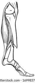 When a bone is broken blood trickles out between the injured parts and afterwards gives place to a sticky watery fluid which gradually becomes thicker like a syrup or jelly, vintage line drawing.