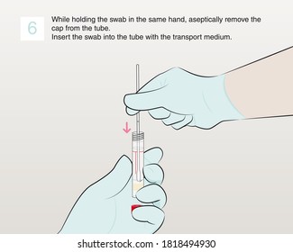 While holding the swab in the same hand, aseptically remove the cap from the tube. Insert the swab into the tube with the transport medium. Step 6