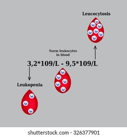 White Blood Cell Count. Leukopenia. Leukocytosis. Infographics. Vector Illustration.