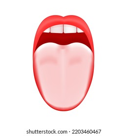 White Or Coated Tongue. Dry Mouth. Open Human Taste Organ With Symptoms Of Stomatitis, Candidiasis Or Glossitis Bacterial Infection Isolated On White Background. Vector Realistic Illustration