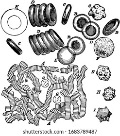 white corpuscle treated with acetic acid and  red corpuscles wrinkled or crenated, vintage line drawing or engraving illustration.