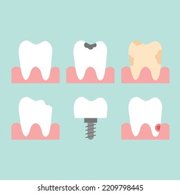 White and decayed teeth, dental implant icon. Vector  set with different tooth conditions. Flat illustration isolated on white background.