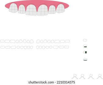 White Dental Mold Print Vektör