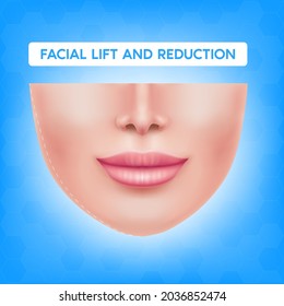 White female face before after plastic surgery jaw reduction and botox injections facial lift and reduction. For advertising of plastic surgery. Medical and beauty concept. Vector EPS10 illustration.