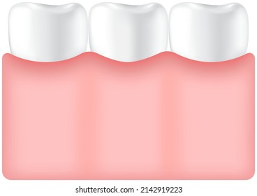 White healthy human teeth in gum. Jaw with molars. Care and hygiene symbol icon. Vector dental medical illustration. Molars with enamel, normal teeth in human gum. Dentistry, oral health care