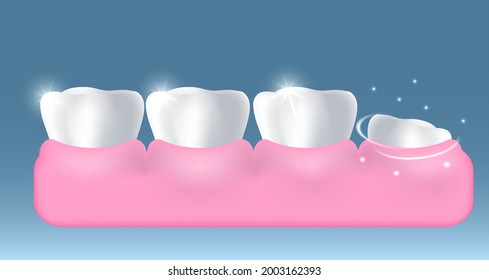 White healthy teeth and growing up new tooth, vector illustration. Stomatology, dentistry, dental health, oral hygiene,