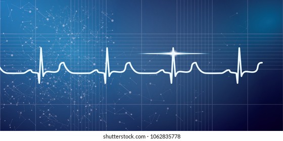 White Heart Beat Pulse Electrocardiogram Rhythm on Blue Background. Vector Illustration. Healthcare ECG or EKG Medical Life Concept for Cardiology.