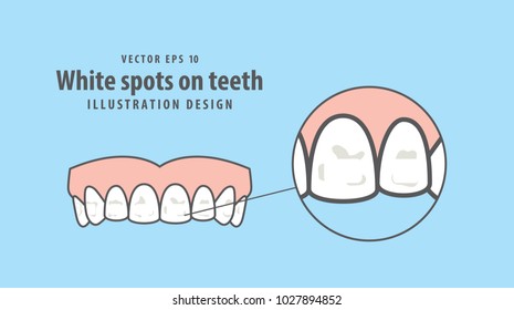 White Spots On Teeth Illustration Vector On Blue Background. Dental Concept.