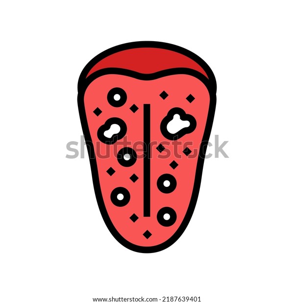 White Spots On Tongue Hiv Symptom 2187639401 Shutterstock   White Spots On Tongue Hiv 600w 2187639401 