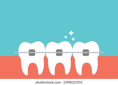 White teeth with dental braces vector flat illustration. Alignment of bite of teeth. Dental clinic service, cosmetic odontology, teeth straightening, and orthodontic procedures concept.