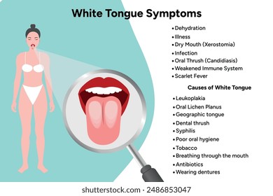 White tongue symptoms, medical information
