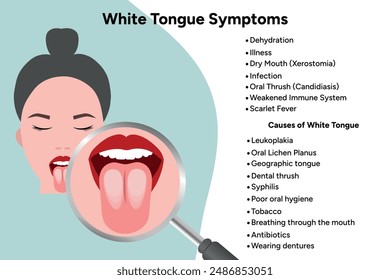 White tongue symptoms, medical information