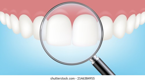 White Tooth With Blue Background And Magnifier With Gradient Mesh, Vector Illustration