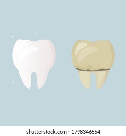 Whitening and teeth cleaning. Tooth before treatment and brushing yellow and sick, after white and healthy. Daily Oral Hygiene. Dental Design Poster. Flat design