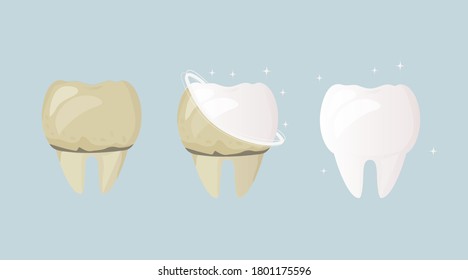 Whitening and teeth cleaning. Tooth before treatment and brushing yellow and sick, after white and healthy. Daily Oral Hygiene. Dental Design Poster. Flat design