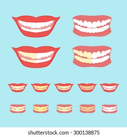 Whitening teeth vector illustration isolated on blue background. Dentistry, card concept. Illustration of smiles showing before and after whitening teeth process.