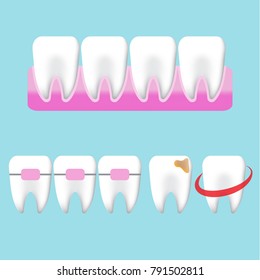 Whitening tooth character illustration on blue background.
