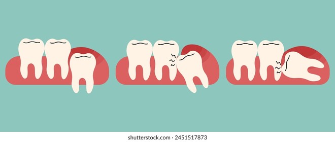 Wisdom teeth 1 cute on a blue-green background, vector illustration.