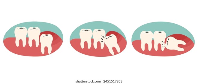 Wisdom teeth 2 cute on a white background, vector illustration.