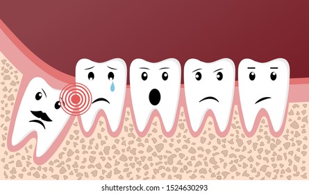 Wisdom teeth dental problems funny concept with cute teeth with different emotions. Vector illustration