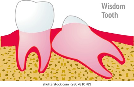 Wisdom teeth are the last to arrive, usually in your late teens, early twenties. Tooth structure. Health dentistry medical drawing. illustration Vector