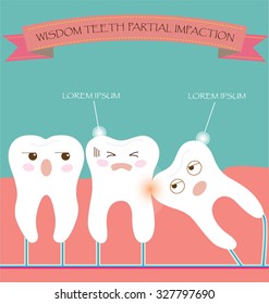 Wisdom Teeth Partial Eruption Impaction