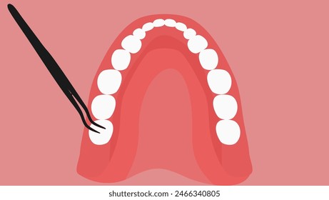 Wisdom Teeth Removal, flat color illustration