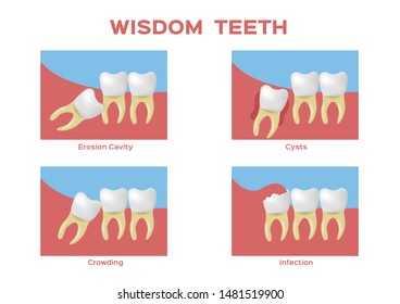 wisdom teeth and tooth vector