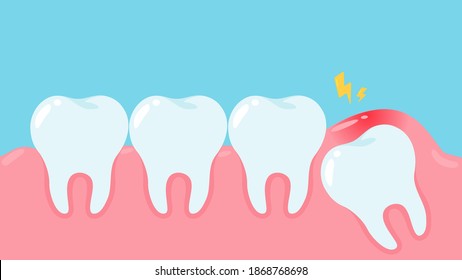 Wisdom teeth under the gums cause pain in the mouth. Dental care concept