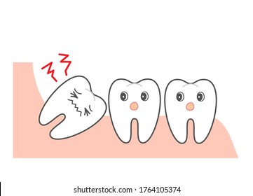  Wisdom tooth and alignment　orthodontic