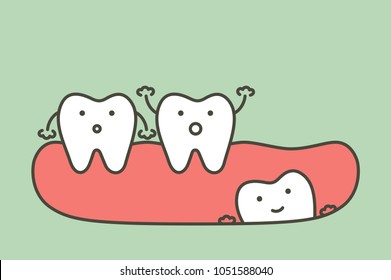 wisdom tooth ( angular or mesial impaction ) affect to other teeth - dental cartoon vector flat style cute character for design