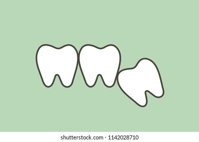 wisdom tooth ( angular or mesial impaction ) affect to other teeth - dental cartoon vector flat style cute character for design