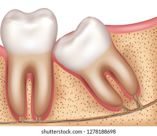 Wisdom tooth eruption problems illustrated anatomy